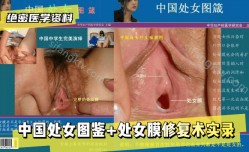 最新上市！【绝密医学资料】中国处女图鉴处女膜修复术实录